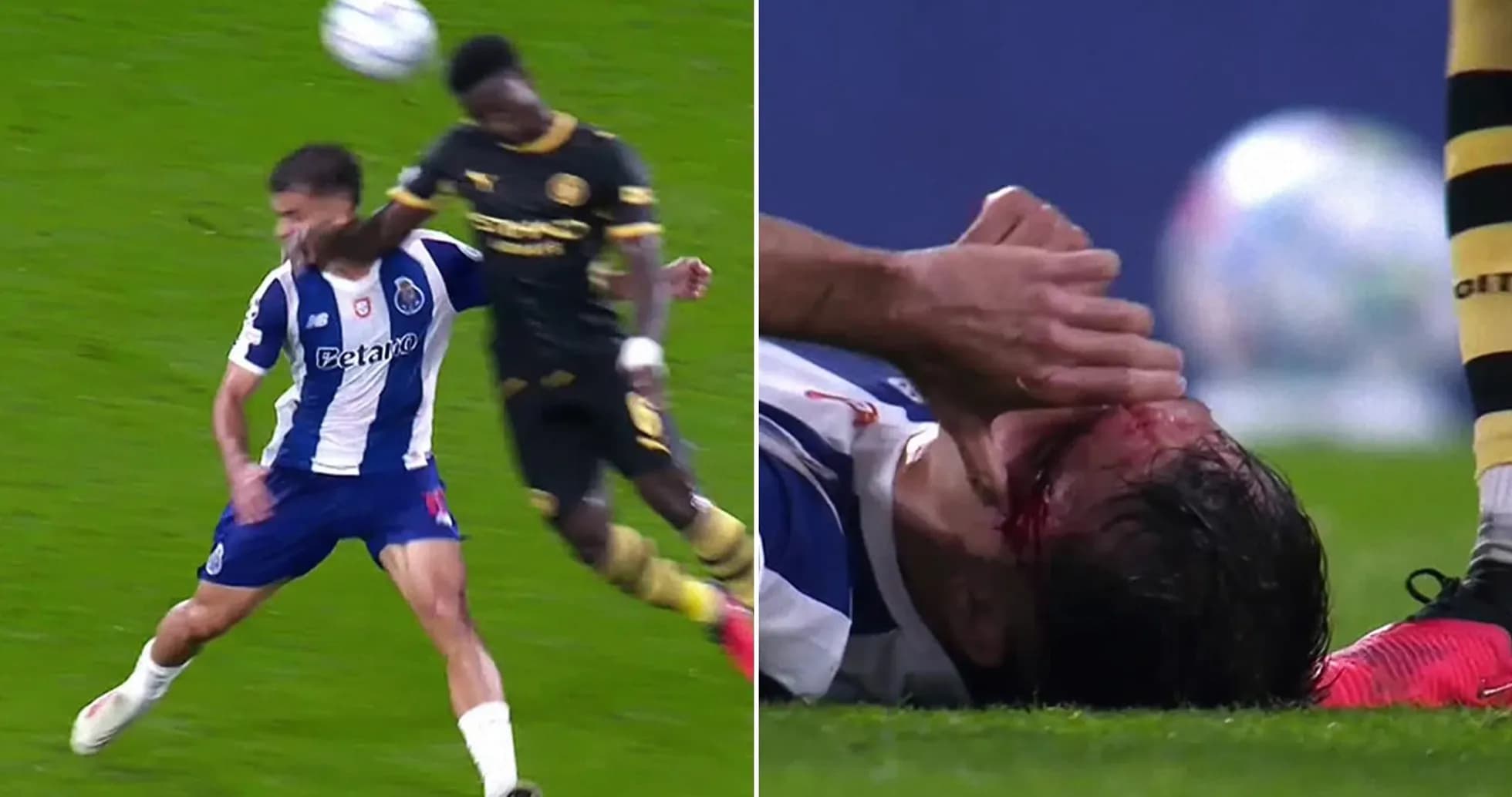 Jugador de Porto cae al suelo con herida en la cabeza