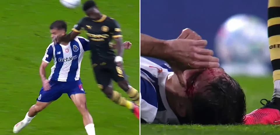 Jugador de Porto cae al suelo con herida en la cabeza